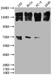 Western Blot; Positive WB detected in: L02 whole cell lysate, Hela whole cell lysate, PC-3 whole cell lysate, A549 whole cell lysate; All lanes: EGFR antibody at 1:2000; Secondary; Goat polyclonal to rabbit IgG at 1/50000 dilution; Predicted band size: 135, 45, 78, 70 kDa; Observed band size: 165 kDa