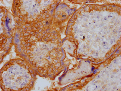IHC image of RAC07309 diluted at 1:100 and staining in paraffin-embedded human placenta tissue performed on a Leica BondTM system. After dewaxing and hydration, antigen retrieval was mediated by high pressure in a citrate buffer (pH 6.0). Section was blocked with 10% normal goat serum 30min at RT. Then primary antibody (1% BSA) was incubated at 4? overnight. The primary is detected by a Goat anti-rabbit IgG polymer labeled by HRP and visualized using 0.05% DAB.