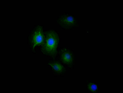 Immunofluorescence staining of A549 Cells with RAC07309 at 1:50, counter-stained with DAPI. The cells were fixed in 4% formaldehyde, permeated by 0.2% TritonX-100, and blocked in 10% normal Goat Serum. The cells were then incubated with the antibody overnight at 4?. Nuclear DNA was labeled in blue with DAPI. The secondary antibody was FITC-conjugated AffiniPure Goat Anti-Rabbit IgG (H+L).