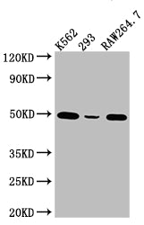 Western Blot; Positive WB detected in: K562 whole cell lysate, 293 whole cell lysate, RAW264.7 whole cell lysate; All lanes: eIF4A1 Antibody at 1:1000; Secondary; Goat polyclonal to rabbit IgG at 1/50000 dilution; Predicted band size: 40, 47 kDa; Observed band size: 50 kDa
