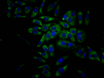 Immunofluorescence staining of Hela Cells with RAC07311 at 1:50, counter-stained with DAPI. The cells were fixed in 4% formaldehyde, permeated by 0.2% TritonX-100, and blocked in 10% normal Goat Serum. The cells were then incubated with the antibody overnight at 4?. Nuclear DNA was labeled in blue with DAPI. The secondary antibody was FITC-conjugated AffiniPure Goat Anti-Rabbit IgG (H+L).
