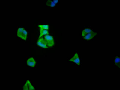 Immunofluorescence staining of Hela Cells with RAC07312 at 1:50, counter-stained with DAPI. The cells were fixed in 4% formaldehyde, permeated by 0.2% TritonX-100, and blocked in 10% normal Goat Serum. The cells were then incubated with the antibody overnight at 4?. Nuclear DNA was labeled in blue with DAPI. The secondary antibody was FITC-conjugated AffiniPure Goat Anti-Rabbit IgG (H+L).