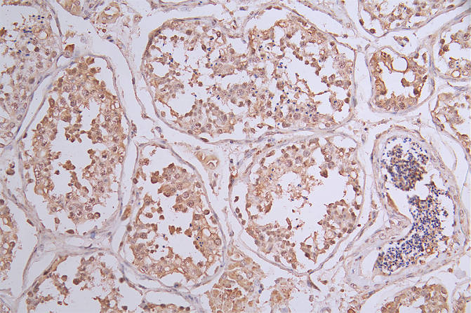 IHC image of RAC07317 diluted at 1:50 and staining in paraffin-embedded human testis tissue performed on a Leica BondTM system. After dewaxing and hydration, antigen retrieval was mediated by high pressure in a citrate buffer (pH 6.0). Section was blocked with 10% normal goat serum 30min at RT. Then primary antibody (1% BSA) was incubated at 4Â°C overnight. The primary is detected by a Goat anti-rabbit polymer IgG labeled by HRP and visualized using 0.23% DAB.