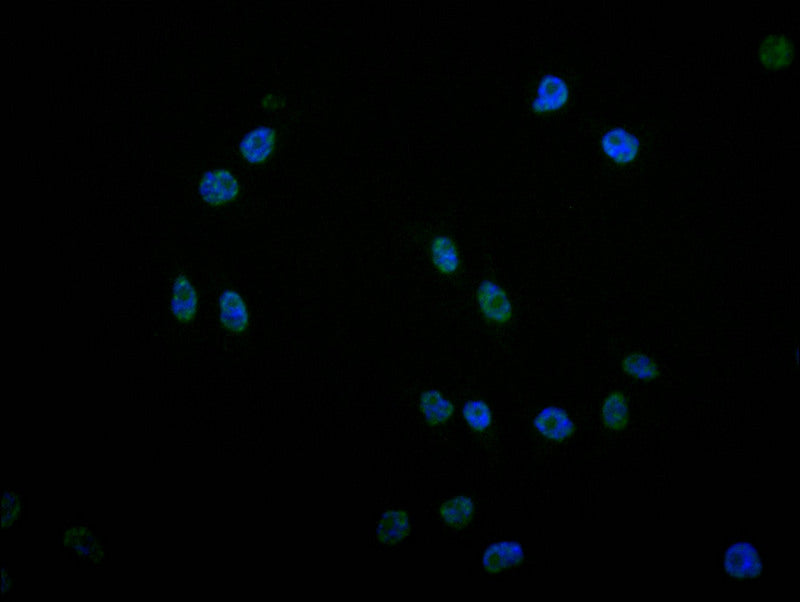 Immunofluorescence staining of MCF7 with RAC07317 at 1:25, counter-stained with DAPI. The cells were fixed in 4% formaldehyde and blocked in 10% normal Goat Serum. The cells were then incubated with the antibody overnight at 4Â°C. The secondary antibody was Alexa Fluor 499-congugated AffiniPure Goat Anti-Rabbit IgG(H+L).