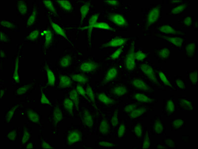 Immunofluorescence staining of Hela Cells with RAC07319 at 1:50, counter-stained with DAPI. The cells were fixed in 4% formaldehyde, permeated by 0.2% TritonX-100, and blocked in 10% normal Goat Serum. The cells were then incubated with the antibody overnight at 4?. Nuclear DNA was labeled in blue with DAPI. The secondary antibody was FITC-conjugated AffiniPure Goat Anti-Rabbit IgG (H+L).