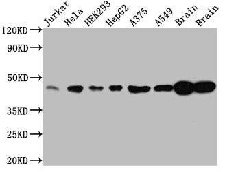 Western Blot; Positive WB detected in: Jurkat whole cell lysate, Hela whole cell lysate, HEK293 whole cell lysate, HepG2 whole cell lysate, A375 whole cell lysate, A549 whole cell lysate, Rat Brain whole cell lysate, Mouse Brain whole cell lysate; All lanes: ERK2 antibody at 1:1000; Secondary; Goat polyclonal to rabbit IgG at 1/50000 dilution; Predicted band size: 42, 37 kDa; Observed band size: 42 kDa