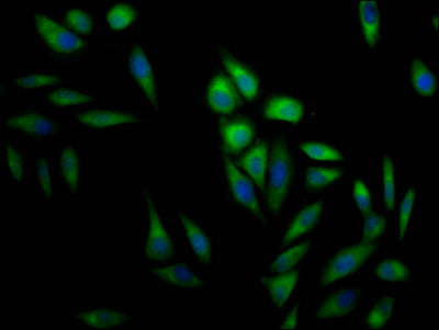 Immunofluorescence staining of Hela Cells with RAC07321 at 1:50, counter-stained with DAPI. The cells were fixed in 4% formaldehyde, permeated by 0.2% TritonX-100, and blocked in 10% normal Goat Serum. The cells were then incubated with the antibody overnight at 4?. Nuclear DNA was labeled in blue with DAPI. The secondary antibody was FITC-conjugated AffiniPure Goat Anti-Rabbit IgG (H+L).