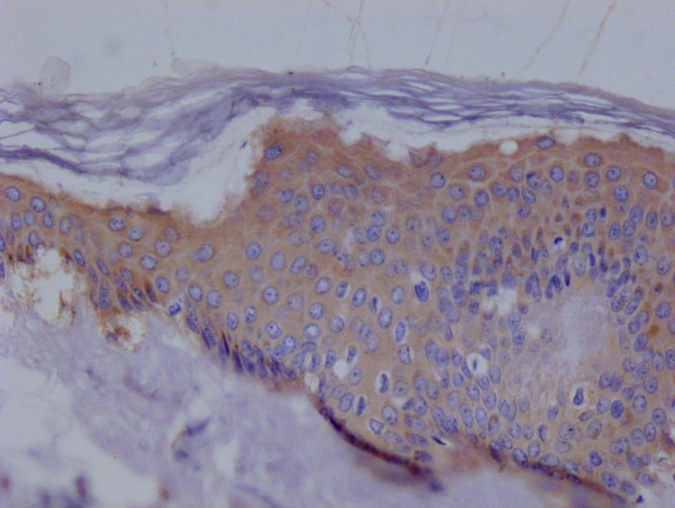 IHC image of RAC07323 diluted at 1:100 and staining in paraffin-embedded human skin tissue performed on a Leica BondTM system. After dewaxing and hydration, antigen retrieval was mediated by high pressure in a citrate buffer (pH 6.0). Section was blocked with 10% normal goat serum 30min at RT. Then primary antibody (1% BSA) was incubated at 4Â°C overnight. The primary is detected by a Goat anti-rabbit polymer IgG labeled by HRP and visualized using 0.05% DAB.