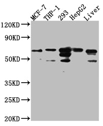 Western Blot; Positive WB detected in: MCF-7 whole cell lysate, THP-1 whole cell lysate, 293 whole cell lysate, HepG2 whole cell lysate, Mouse Liver whole cell lysate; All lanes: FAAH1 Antibody at 1:1000; Secondary; Goat polyclonal to rabbit IgG at 1/50000 dilution; Predicted band size: 64 kDa; Observed band size: 64 kDa