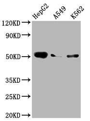 Western Blot; Positive WB detected in: HepG2 whole cell lysate, A549 whole cell lysate, K562 whole cell lysate; All lanes: Factor IX antibody at 1:2000; Secondary; Goat polyclonal to rabbit IgG at 1/50000 dilution; Predicted band size: 52 kDa; Observed band size: 52 kDa