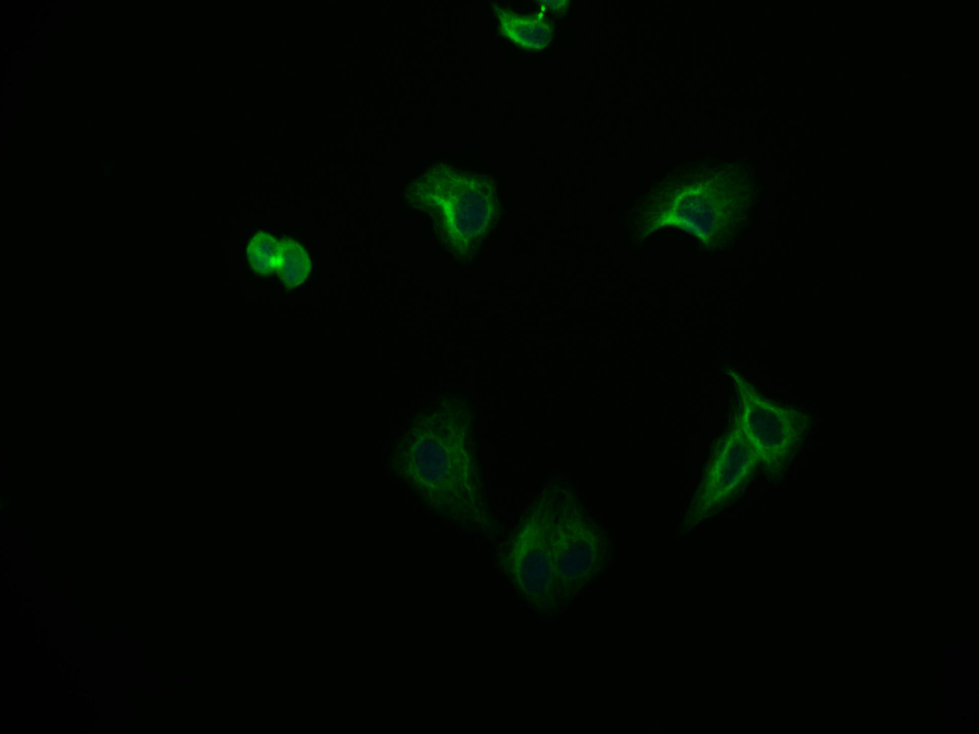 Immunofluorescence staining of HepG2 cell with RAC07328 at 1:50, counter-stained with DAPI. The cells were fixed in 4% formaldehyde and blocked in 10% normal Goat Serum. The cells were then incubated with the antibody overnight at 4Â°C. The secondary antibody was Alexa Fluor 565-congugated AffiniPure Goat Anti-Rabbit IgG(H+L).