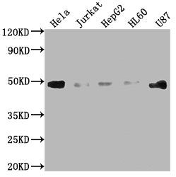 Western Blot; Positive WB detected in: Hela whole cell lysate, Jurkat whole cell lysate, HepG2 whole cell lysate, HL60 whole cell lysate, U87 whole cell lysate; All lanes: FAS antibody at 1:2000; Secondary; Goat polyclonal to rabbit IgG at 1/50000 dilution; Predicted band size: 38, 12, 10, 17, 15, 36, 25 kDa; Observed band size: 45 kDa