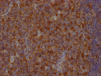IHC image of RAC07330 diluted at 1:100 and staining in paraffin-embedded human tonsil tissue performed on a Leica BondTM system. After dewaxing and hydration, antigen retrieval was mediated by high pressure in a citrate buffer (pH 6.0). Section was blocked with 10% normal goat serum 30min at RT. Then primary antibody (1% BSA) was incubated at 4? overnight. The primary is detected by a Goat anti-rabbit IgG polymer labeled by HRP and visualized using 0.05% DAB.