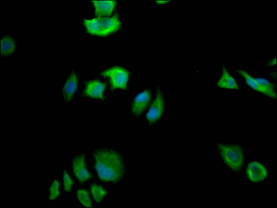 Immunofluorescence staining of Hela Cells with RAC07331 at 1:50, counter-stained with DAPI. The cells were fixed in 4% formaldehyde, permeated by 0.2% TritonX-100, and blocked in 10% normal Goat Serum. The cells were then incubated with the antibody overnight at 4?. Nuclear DNA was labeled in blue with DAPI. The secondary antibody was FITC-conjugated AffiniPure Goat Anti-Rabbit IgG (H+L).