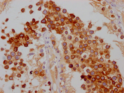 IHC image of RAC07333 diluted at 1:100 and staining in paraffin-embedded human testis tissue performed on a Leica BondTM system. After dewaxing and hydration, antigen retrieval was mediated by high pressure in a citrate buffer (pH 6.0). Section was blocked with 10% normal goat serum 30min at RT. Then primary antibody (1% BSA) was incubated at 4? overnight. The primary is detected by a Goat anti-rabbit IgG polymer labeled by HRP and visualized using 0.05% DAB.