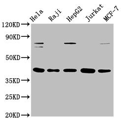 Western Blot; Positive WB detected in: Hela whole cell lysate, Raji whole cell lysate, HepG2 whole cell lysate, Jurkat whole cell lysate, MCF-7 whole cell lysate; All lanes: FEN1 antibody at 0.775ug/ml; Secondary; Goat polyclonal to rabbit IgG at 1/50000 dilution; Predicted band size: 43, 36 KDa; Observed band size: 43 KDa