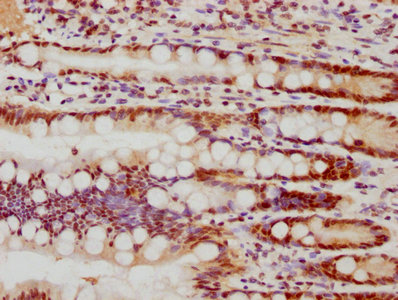 IHC image of RAC07335 diluted at 1:77.5 and staining in paraffin-embedded human small intestine tissue performed on a Leica BondTM system. After dewaxing and hydration, antigen retrieval was mediated by high pressure in a citrate buffer (pH 6.0). Section was blocked with 10% normal goat serum 30min at RT. Then primary antibody (1% BSA) was incubated at 4? overnight. The primary is detected by a biotinylated secondary antibody and visualized using an HRP conjugated SP system.