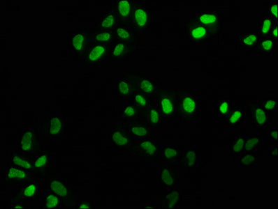 Immunofluorescence staining of Hela cells with RAC07335 at 1:25, counter-stained with DAPI. The cells were fixed in 4% formaldehyde, permeabilized using 0.2% Triton X-100 and blocked in 10% normal Goat Serum. The cells were then incubated with the antibody overnight at 4?. The secondary antibody was Alexa Fluor 488-congugated AffiniPure Goat Anti-Rabbit IgG (H+L).
