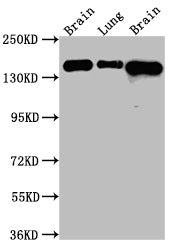 Western Blot; Positive WB detected in: Rat Brain whole cell lysate, Rat Lung whole cell lysate, Mouse Brain whole cell lysate; All lanes: FGFR2 Antibody at 1:1000; Secondary; Goat polyclonal to rabbit IgG at 1/50000 dilution; Predicted band size: 93, 87, 93, 77, 92, 89, 86, 29, 80, 93, 97, 92, 41, 80, 80, 77, 80 kDa; Observed band size: 145 kDa