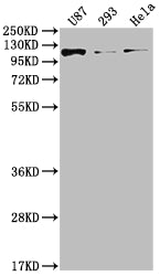 Western Blot; Positive WB detected in: U87 whole cell lysate, 293 whole cell lysate, Hela whole cell lysate; All lanes: FGFR3 antibody at 1:2000; Secondary; Goat polyclonal to rabbit IgG at 1/50000 dilution; Predicted band size: 88, 89, 76, 86 kDa; Observed band size: 115 kDa