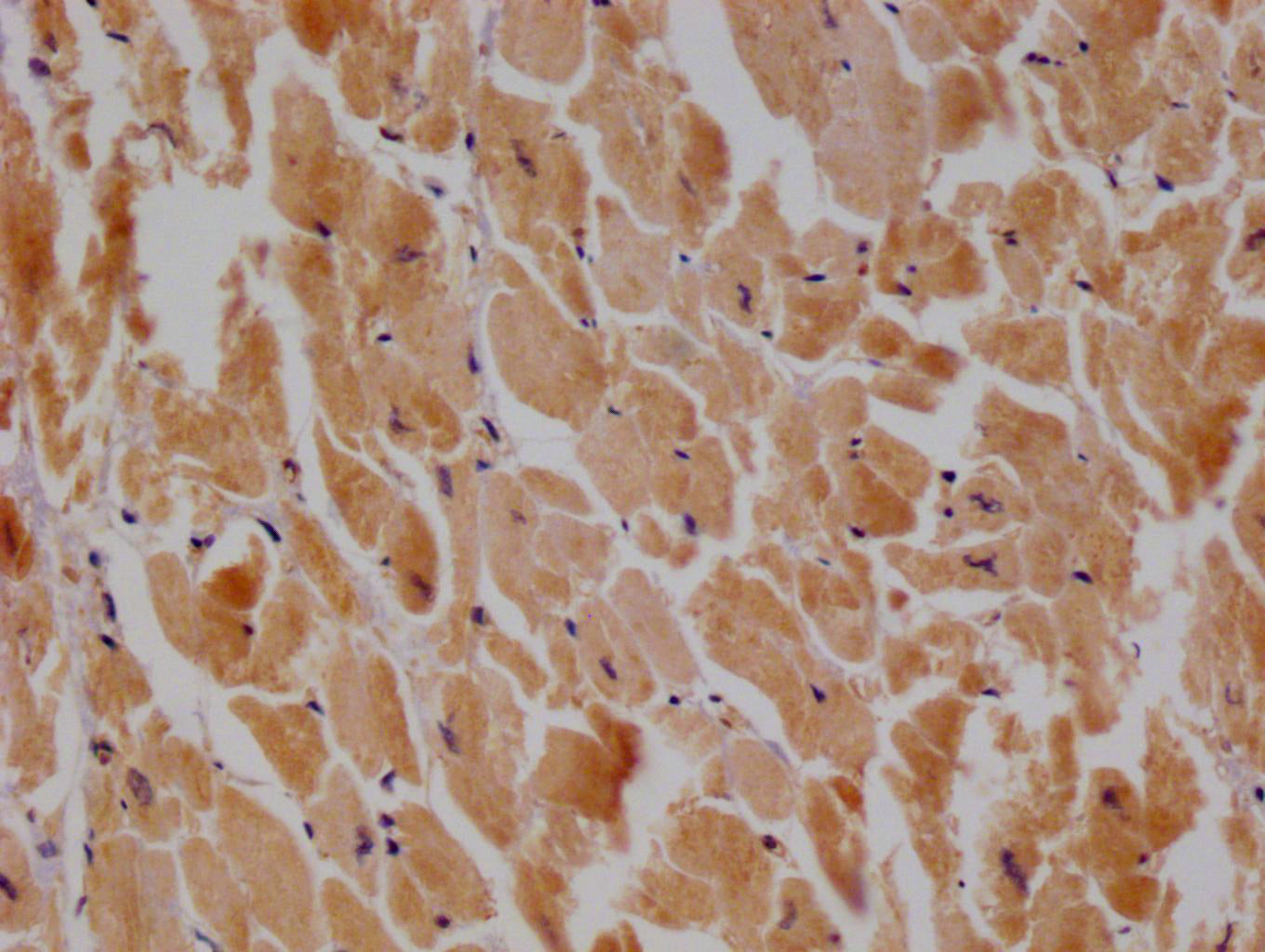 IHC image of RAC07343 diluted at 1:100 and staining in paraffin-embedded human heart tissue performed on a Leica BondTM system. After dewaxing and hydration, antigen retrieval was mediated by high pressure in a citrate buffer (pH 6.0). Section was blocked with 10% normal goat serum 30min at RT. Then primary antibody (1% BSA) was incubated at 4Â°C overnight. The primary is detected by a Goat anti-rabbit polymer IgG labeled by HRP and visualized using 0.05% DAB.