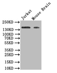 Western Blot; Positive WB detected in: JK whole cell lysate, Mouse Brain tissue lysate; All lanes: VEGF Receptor 1 antibody at 1:500; Secondary; Goat polyclonal to rabbit IgG at 1/50000 dilution; Predicted band size: 150 kDa; Observed band size: 150 kDa