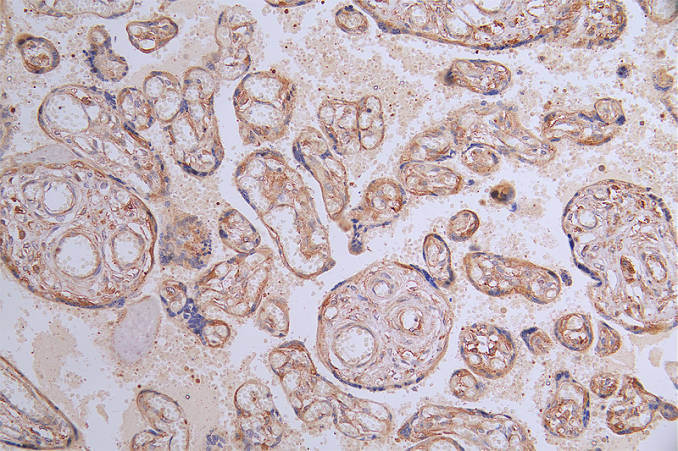 IHC image of RAC07344 diluted at 1:100 and staining in paraffin-embedded human placenta tissue performed on a Leica BondTM system. After dewaxing and hydration, antigen retrieval was mediated by high pressure in a citrate buffer (pH 6.0). Section was blocked with 10% normal goat serum 30min at RT. Then primary antibody (1% BSA) was incubated at 4Â°C overnight. The primary is detected by a Goat anti-rabbit polymer IgG labeled by HRP and visualized using 0.21% DAB.