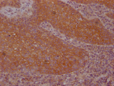 IHC image of RAC07346 diluted at 1:100 and staining in paraffin-embedded human tonsil tissue performed on a Leica BondTM system. After dewaxing and hydration, antigen retrieval was mediated by high pressure in a citrate buffer (pH 6.0). Section was blocked with 10% normal goat serum 30min at RT. Then primary antibody (1% BSA) was incubated at 4? overnight. The primary is detected by a Goat anti-rabbit IgG polymer labeled by HRP and visualized using 0.05% DAB.