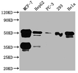 Western Blot; Positive WB detected in: MCF-7 whole cell lysate, HepG2 whole cell lysate, PC-3 whole cell lysate, 293 whole cell lysate, Hela whole cell lysate; All lanes: FOXA1 antibody at 1:2000; Secondary; Goat polyclonal to rabbit IgG at 1/50000 dilution; Predicted band size: 50, 46 kDa; Observed band size: 50 kDa