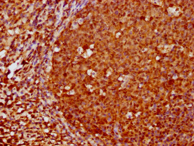 IHC image of RAC07348 diluted at 1:180 and staining in paraffin-embedded human tonsil tissue performed on a Leica BondTM system. After dewaxing and hydration, antigen retrieval was mediated by high pressure in a citrate buffer (pH 6.0). Section was blocked with 10% normal goat serum 30min at RT. Then primary antibody (1% BSA) was incubated at 4? overnight. The primary is detected by a biotinylated secondary antibody and visualized using an HRP conjugated SP system.