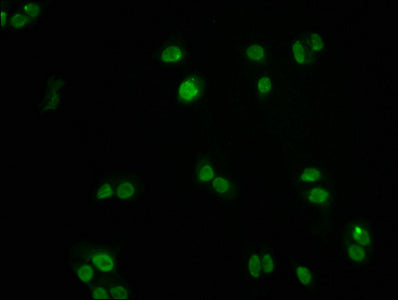 Immunofluorescence staining of PC3 cells with RAC07348 at 1:60, counter-stained with DAPI. The cells were fixed in 4% formaldehyde, permeabilized using 0.2% Triton X-100 and blocked in 10% normal Goat Serum. The cells were then incubated with the antibody overnight at 4?. The secondary antibody was Alexa Fluor 488-congugated AffiniPure Goat Anti-Rabbit IgG (H+L).