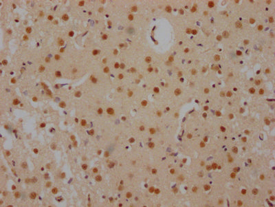 IHC image of RAC07353 diluted at 1:100 and staining in paraffin-embedded human brain tissue performed on a Leica BondTM system. After dewaxing and hydration, antigen retrieval was mediated by high pressure in a citrate buffer (pH 6.0). Section was blocked with 10% normal goat serum 30min at RT. Then primary antibody (1% BSA) was incubated at 4? overnight. The primary is detected by a Goat anti-rabbit IgG polymer labeled by HRP and visualized using 0.05% DAB.