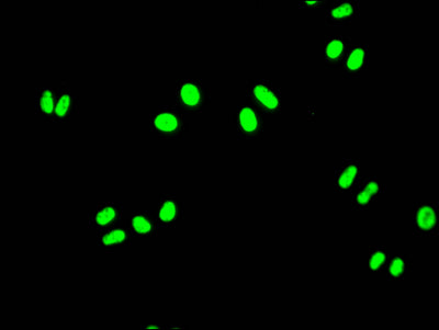Immunofluorescence staining of Hela Cells with RAC07353 at 1:50, counter-stained with DAPI. The cells were fixed in 4% formaldehyde, permeated by 0.2% TritonX-100, and blocked in 10% normal Goat Serum. The cells were then incubated with the antibody overnight at 4?. Nuclear DNA was labeled in blue with DAPI. The secondary antibody was FITC-conjugated AffiniPure Goat Anti-Rabbit IgG (H+L).