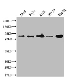 Western Blot; Positive WB detected in: A549 whole cell lysate, Hela whole cell lysate, A375 whole cell lysate, HT-29 whole cell lysate, HepG2 whole cell lysate, U-87 whole cell lysate; All lanes: Furin antibody at 1:1000; Secondary; Goat polyclonal to rabbit IgG at 1/50000 dilution; Predicted band size: 87 kDa; Observed band size: 87, 72 kDa