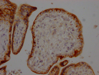 IHC image of RAC07354 diluted at 1:100 and staining in paraffin-embedded human placenta tissue performed on a Leica BondTM system. After dewaxing and hydration, antigen retrieval was mediated by high pressure in a citrate buffer (pH 6.0). Section was blocked with 10% normal goat serum 30min at RT. Then primary antibody (1% BSA) was incubated at 4? overnight. The primary is detected by a Goat anti-rabbit IgG polymer labeled by HRP and visualized using 0.05% DAB.