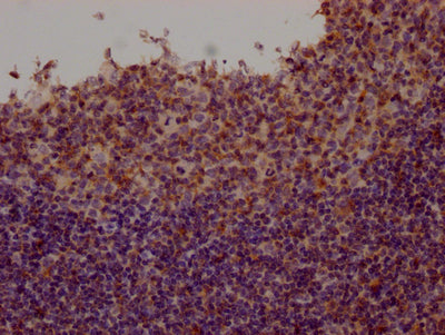 IHC image of RAC07355 diluted at 1:100 and staining in paraffin-embedded human tonsil tissue performed on a Leica BondTM system. After dewaxing and hydration, antigen retrieval was mediated by high pressure in a citrate buffer (pH 6.0). Section was blocked with 10% normal goat serum 30min at RT. Then primary antibody (1% BSA) was incubated at 4? overnight. The primary is detected by a Goat anti-rabbit IgG polymer labeled by HRP and visualized using 0.05% DAB.