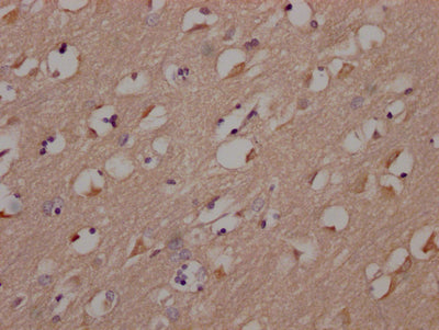 IHC image of RAC07355 diluted at 1:100 and staining in paraffin-embedded human brain tissue performed on a Leica BondTM system. After dewaxing and hydration, antigen retrieval was mediated by high pressure in a citrate buffer (pH 6.0). Section was blocked with 10% normal goat serum 30min at RT. Then primary antibody (1% BSA) was incubated at 4? overnight. The primary is detected by a Goat anti-rabbit IgG polymer labeled by HRP and visualized using 0.05% DAB.
