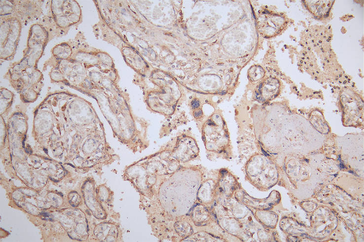IHC image of RAC07356 diluted at 1:50 and staining in paraffin-embedded human placenta tissue performed on a Leica BondTM system. After dewaxing and hydration, antigen retrieval was mediated by high pressure in a citrate buffer (pH 6.0). Section was blocked with 10% normal goat serum 30min at RT. Then primary antibody (1% BSA) was incubated at 4Â°C overnight. The primary is detected by a Goat anti-rabbit polymer IgG labeled by HRP and visualized using 0.15% DAB.