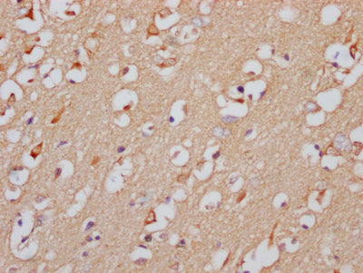 IHC image of RAC07357 diluted at 1:100 and staining in paraffin-embedded human brain tissue performed on a Leica BondTM system. After dewaxing and hydration, antigen retrieval was mediated by high pressure in a citrate buffer (pH 6.0). Section was blocked with 10% normal goat serum 30min at RT. Then primary antibody (1% BSA) was incubated at 4? overnight. The primary is detected by a Goat anti-rabbit IgG polymer labeled by HRP and visualized using 0.05% DAB.