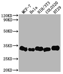 Western Blot; Positive WB detected in: MCF-7 whole cell lysate, Hela whole cell lysate, NIH/3T3 whole cell lysate, Colo320 whole cell lysate, HT29 whole cell lysate; All lanes: Galectin 3 antibody at 1:2000; Secondary; Goat polyclonal to rabbit IgG at 1/50000 dilution; Predicted band size: 27 kDa; Observed band size: 31 kDa