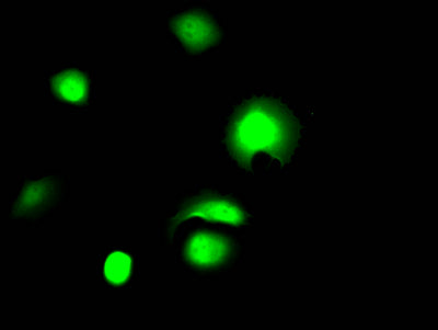 Immunofluorescence staining of MCF7 Cells with RAC07358 at 1:50, counter-stained with DAPI. The cells were fixed in 4% formaldehyde, permeated by 0.2% TritonX-100, and blocked in 10% normal Goat Serum. The cells were then incubated with the antibody overnight at 4?. Nuclear DNA was labeled in blue with DAPI. The secondary antibody was FITC-conjugated AffiniPure Goat Anti-Rabbit IgG (H+L).