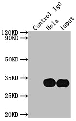 Immunoprecipitating LGALS3 in Hela whole cell lysate; Lane 1: Rabbit control IgG instead of RAC07358 in Hela whole cell lysate.For western blotting,a HRP-conjugated Protein G antibody was used as the secondary antibody (1/2000); Lane 2: RAC07358(2ug)+ Hela whole cell lysate(500ug); Lane 3: Hela whole cell lysate (10ug)