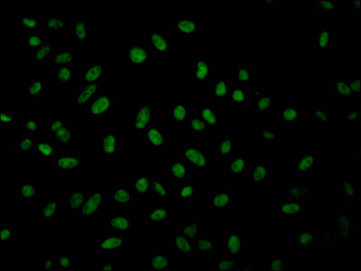 Immunofluorescence staining of Hela Cells with RAC07362 at 1:50, counter-stained with DAPI. The cells were fixed in 4% formaldehyde, permeated by 0.2% TritonX-100, and blocked in 10% normal Goat Serum. The cells were then incubated with the antibody overnight at 4?. Nuclear DNA was labeled in blue with DAPI. The secondary antibody was FITC-conjugated AffiniPure Goat Anti-Rabbit IgG (H+L).