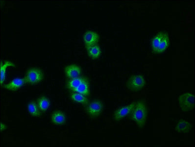 Immunofluorescence staining of HepG2 cells with RAC07368 at 1:30, counter-stained with DAPI. The cells were fixed in 4% formaldehyde, permeabilized using 0.2% Triton X-100 and blocked in 10% normal Goat Serum. The cells were then incubated with the antibody overnight at 4?. The secondary antibody was Alexa Fluor 488-congugated AffiniPure Goat Anti-Rabbit IgG (H+L).