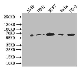 Western Blot; Positive WB detected in: A549 whole cell lysate, U251 whole cell lysate,MCF7 whole cell lysate,HELA whole cell lysate,PC-3 whole cell lysate; All lanes: Glucose 6 phosphate isomerase antibody at 1:1000; Secondary; Goat polyclonal to rabbit IgG at 1/50000 dilution; Predicted band size: 63 kDa; Observed band size: 63 kDa