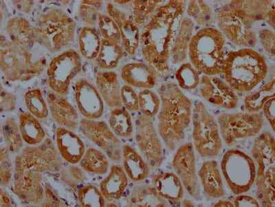IHC image of RAC07371 diluted at 1:100 and staining in paraffin-embedded human kidney tissue performed on a Leica BondTM system. After dewaxing and hydration, antigen retrieval was mediated by high pressure in a citrate buffer (pH 6.0). Section was blocked with 10% normal goat serum 30min at RT. Then primary antibody (1% BSA) was incubated at 4? overnight. The primary is detected by a Goat anti-rabbit IgG polymer labeled by HRP and visualized using 0.05% DAB.