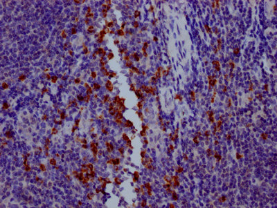 IHC image of RAC07373 diluted at 1:100 and staining in paraffin-embedded human tonsil tissue performed on a Leica BondTM system. After dewaxing and hydration, antigen retrieval was mediated by high pressure in a citrate buffer (pH 6.0). Section was blocked with 10% normal goat serum 30min at RT. Then primary antibody (1% BSA) was incubated at 4? overnight. The primary is detected by a Goat anti-rabbit IgG polymer labeled by HRP and visualized using 0.05% DAB.