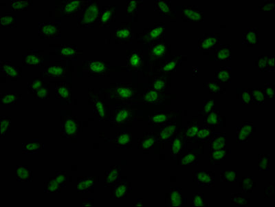 Immunofluorescence staining of Hela Cells with RAC07373 at 1:50, counter-stained with DAPI. The cells were fixed in 4% formaldehyde, permeated by 0.2% TritonX-100, and blocked in 10% normal Goat Serum. The cells were then incubated with the antibody overnight at 4?. Nuclear DNA was labeled in blue with DAPI. The secondary antibody was FITC-conjugated AffiniPure Goat Anti-Rabbit IgG (H+L).