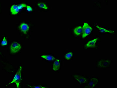 Immunofluorescence staining of MCF-7 cells with RAC07376 at 1:56, counter-stained with DAPI. The cells were fixed in 4% formaldehyde, permeabilized using 0.2% Triton X-100 and blocked in 10% normal Goat Serum. The cells were then incubated with the antibody overnight at 4?. The secondary antibody was Alexa Fluor 488-congugated AffiniPure Goat Anti-Rabbit IgG (H+L).