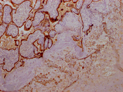IHC image of RAC07378 diluted at 1:100 and staining in paraffin-embedded human placenta tissue performed on a Leica BondTM system. After dewaxing and hydration, antigen retrieval was mediated by high pressure in a citrate buffer (pH 6.0). Section was blocked with 10% normal goat serum 30min at RT. Then primary antibody (1% BSA) was incubated at 4? overnight. The primary is detected by a Goat anti-rabbit IgG polymer labeled by HRP and visualized using 0.05% DAB.